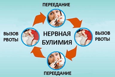 Лечение булимии в Торбеево